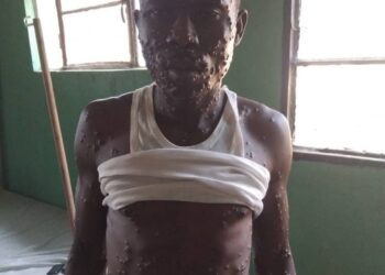 Burundi: Indwara Idasanzwe Yagaragaye kwa perezida Evariste Ndayishimiye