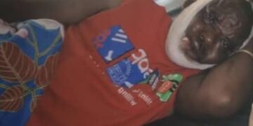 COL. MAYELE NYUMA YO KUGERAGEZA KWIYICA BASANZE AGIHUMEKA NUBWO AREMBYE