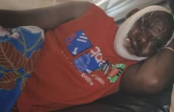 COL. MAYELE NYUMA YO KUGERAGEZA KWIYICA BASANZE AGIHUMEKA NUBWO AREMBYE